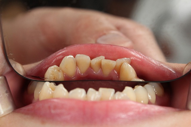 dentist-640x480-36781477.jpeg