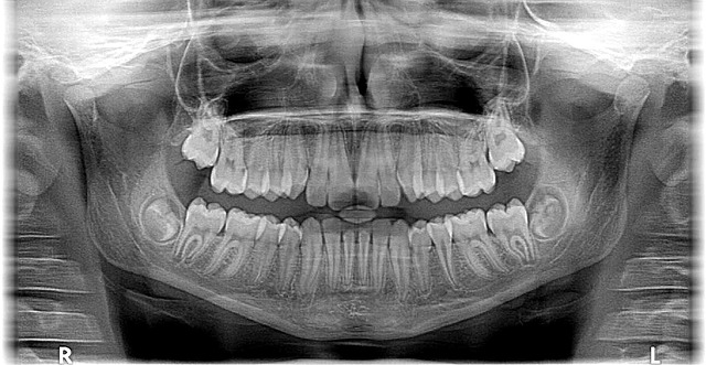 braces mcallen tx