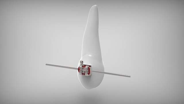 Top Orthodontia in McAllen, TX: Braces for a Perfect Smile