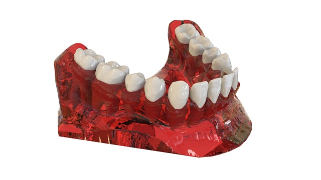 dental-implants-mcallen-640x480-27310568.jpeg