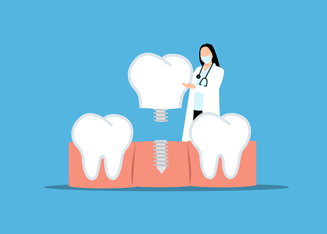 Dental Implants McAllen TX: Comprehensive Guide to Permanent Tooth Replacement