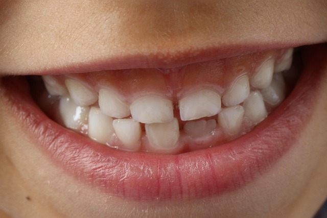 dental mcallen tx