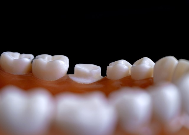 Top Dental Services in McAllen TX: A Comprehensive Guide for All