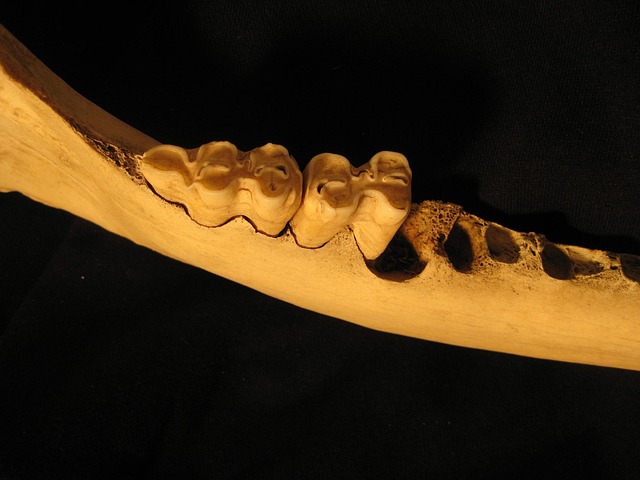 dentist-640x480-5507260.jpeg