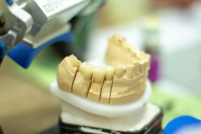 McAllen Dentist: Advanced Gum Disease & Tooth Loss Solutions