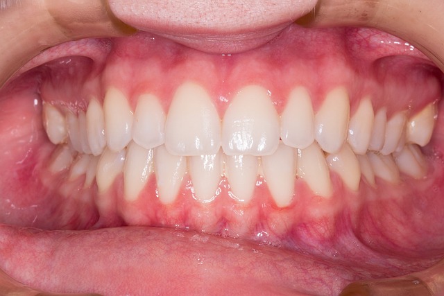 dentist mcallen tx