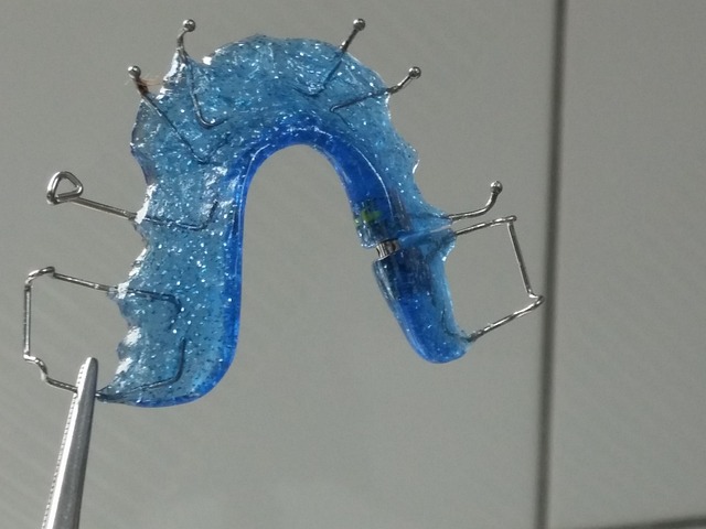 mcallen-tx-braces-640x480-69054292.jpeg