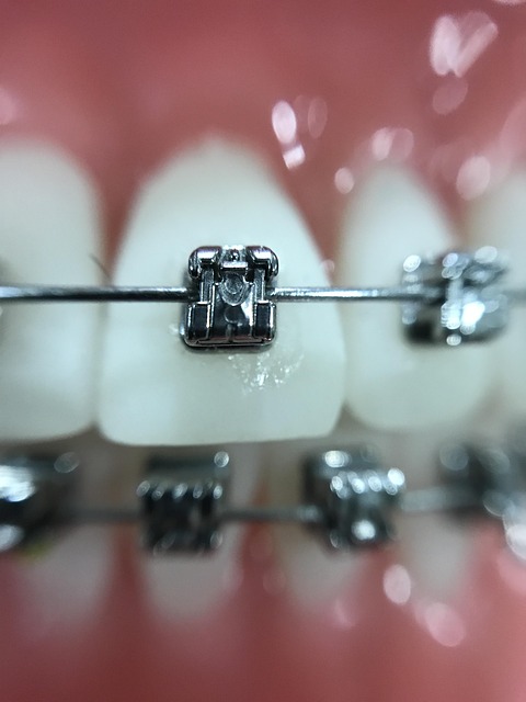 orthodontics-mcallen-tx-640x480-46088160.jpeg