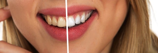 where-can-i-find-affordable-dental-care-640x480-32446858.jpeg