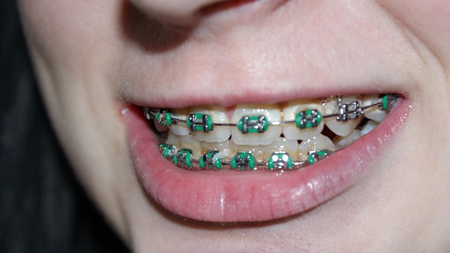 braces mcallen tx