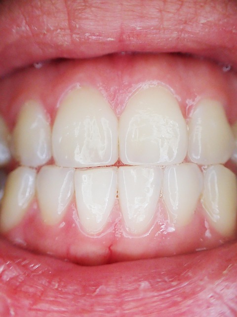 dentist-640x480-87920685.jpeg
