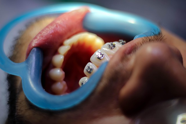 braces mcallen tx
