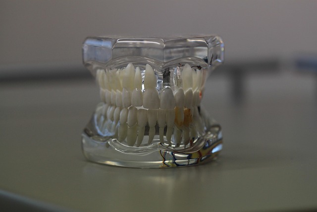 La Joya Dental Penitas TX: Transform Your Smile Brighter