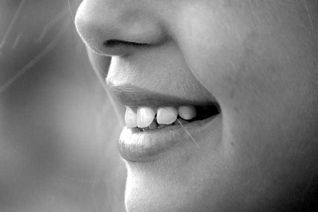 teeth whitening in mcallen tx