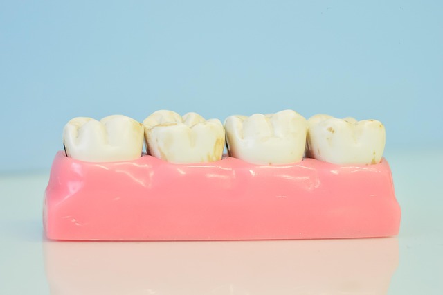 teeth whitening mcallen