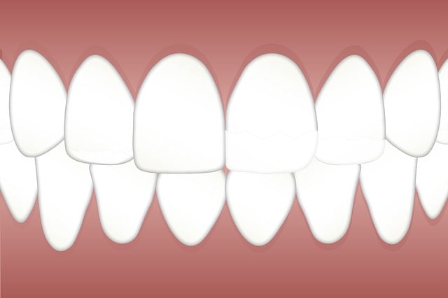 teeth whitening mcallen