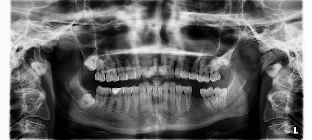 teeth-whitening-mcallen-tx-640x480-89951332.jpeg