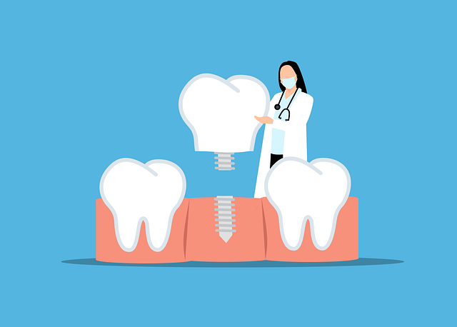 How do I prepare for a dental implant procedure in McAllen